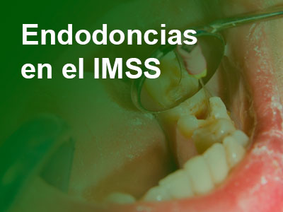 Endodoncias en el IMSS